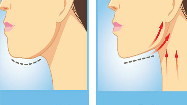 Yoga Poses to Naturally Reduce Double Chin