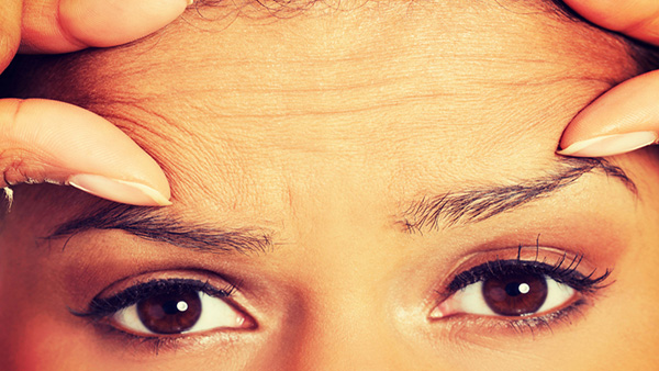 Facial Lines and Wrinkles