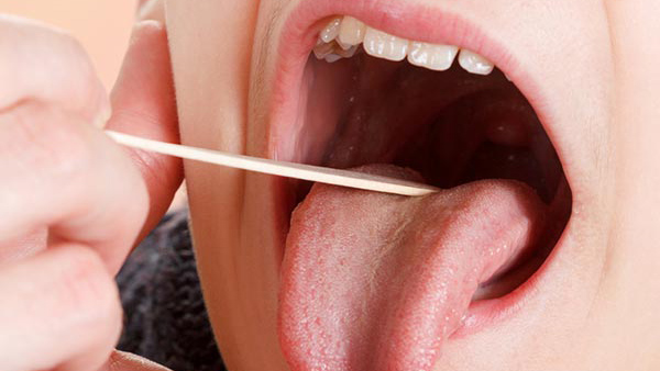 mouth symptoms Disease