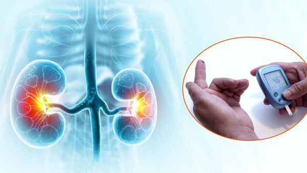 Kidney Disease Symptoms