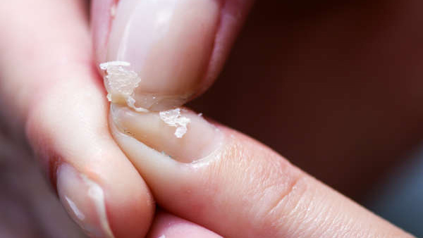 Protein deficiency Protein deficiency