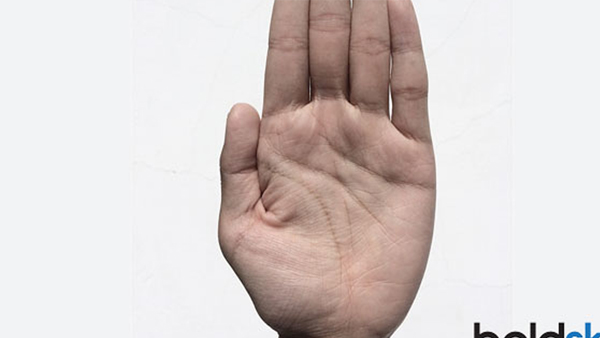 Lucky and Unlucky Moles