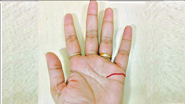 Lucky and Unlucky Moles