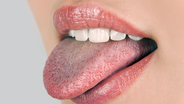 tongue health