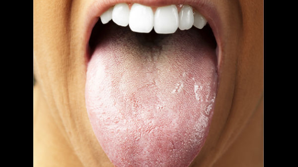 tongue health