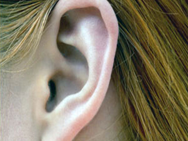 Ear Shape