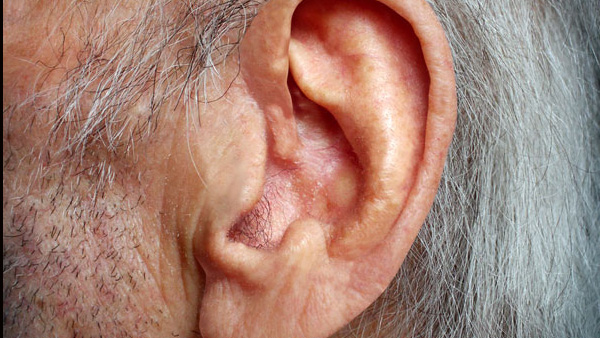 Ear Shape