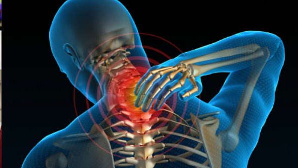Stiff neck remedies Stiff neck remedies