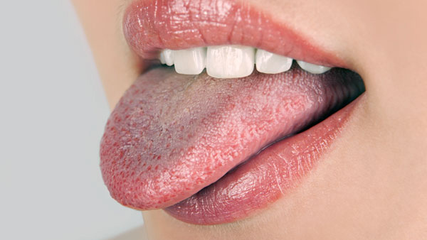 White Layer on Tongue