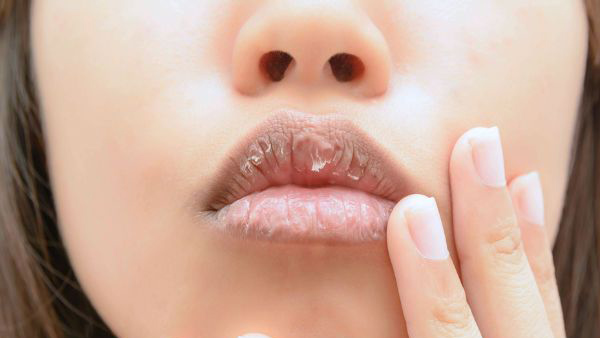 lip color and health