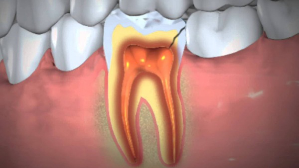 Oral Health Warning Signs