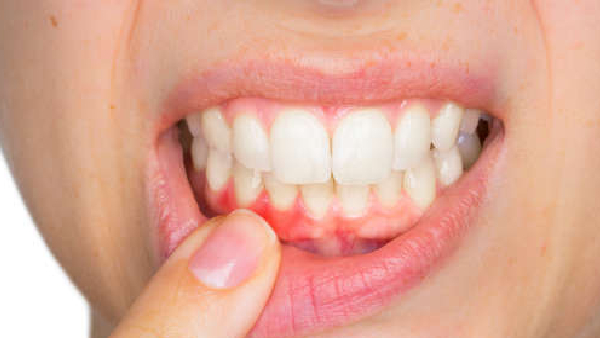 Oral Health Warning Signs