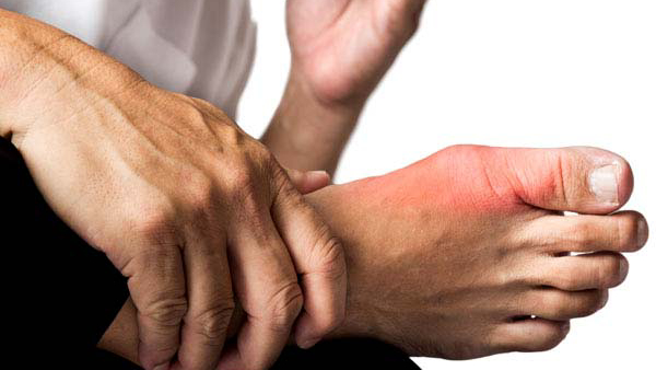 high uric acid uric acid effect