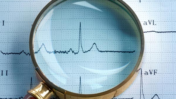 heart attack risk heart attack risk