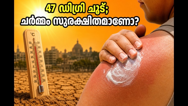 Heatwave Skin Protection: Essential Sunscreen Tips and Scalp Care for May 2026 Heatwave Safety