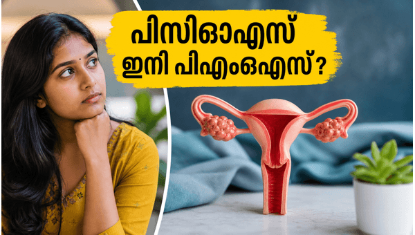 PMOS: PCOS Renamed to Polycystic Metabolic Ovarian Syndrome - New Treatment Guidelines for Women in 2026