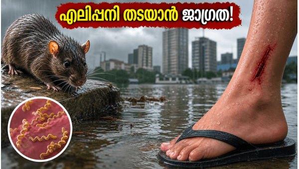 Heavy Rain in Kerala and Mumbai 2026: Essential Health Tips to Prevent Leptospirosis and Infections