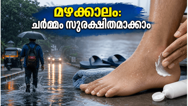 Monsoon Skin Care: Essential Tips to Prevent Fungal Infections and Stay Safe in 2026