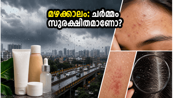 Monsoon Skin Care Tips: How to Prevent Fungal Acne and Dandruff in Humid Weather 2026 Guide Monsoon Skin Care Tips: How to Prevent Fungal Acne and Dandruff in Humid Weather 2026 Guide