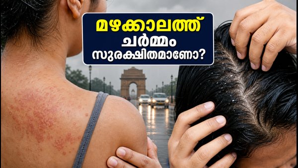 Delhi Monsoon Skincare Guide: Essential Tips to Protect Skin and Hair from Fungal Infections 2026 Delhi Monsoon Skincare Guide: Essential Tips to Protect Skin and Hair from Fungal Infections 2026