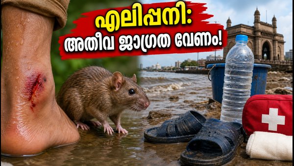 Leptospirosis Prevention Tips: How to Stay Safe During Mumbai Monsoon 2026 Leptospirosis Prevention Tips: How to Stay Safe During Mumbai Monsoon 2026