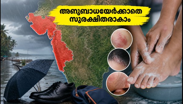 Monsoon Skin and Foot Care Tips 2026: Essential Precautions to Prevent Infections During Heavy Rains