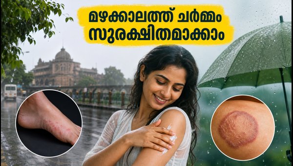Monsoon Skin Care Tips for UP and Bihar: How to Prevent Fungal Infections During Heavy Rains 2026 Monsoon Skin Care Tips for UP and Bihar: How to Prevent Fungal Infections During Heavy Rains 2026