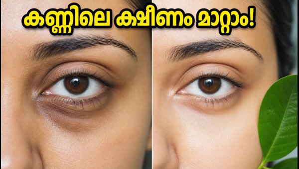 Skincare Tips for Puffy Eyes and Fatigue After Late Night World Cup Watching: Easy Remedies for 2026 Skincare Tips for Puffy Eyes and Fatigue After Late Night World Cup Watching: Easy Remedies for 2026