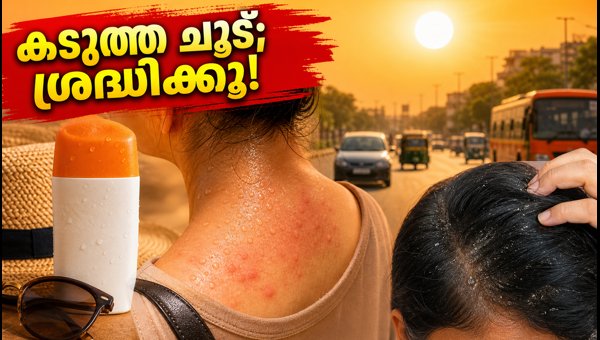 South India Heatwave Alert: Essential Skin and Scalp Care Tips for Summer Humidity and UV Protection South India Heatwave Alert: Essential Skin and Scalp Care Tips for Summer Humidity and UV Protection