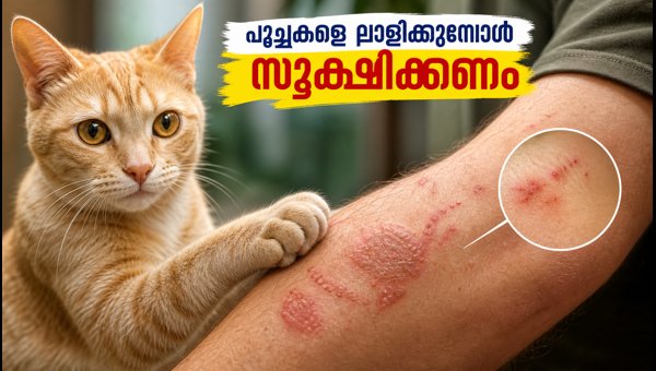 Cat Care Tips for Monsoon 2026: How to Prevent Skin Infections and Ringworm from Your Pets Effectively Cat Care Tips for Monsoon 2026: How to Prevent Skin Infections and Ringworm from Your Pets Effectively