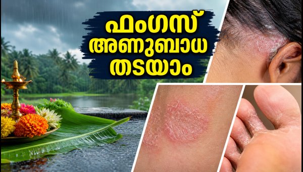 Monsoon Skin and Hair Care: How to Prevent Fungal Infections and Dandruff During Rainy Season 2026 Monsoon Skin and Hair Care: How to Prevent Fungal Infections and Dandruff During Rainy Season 2026