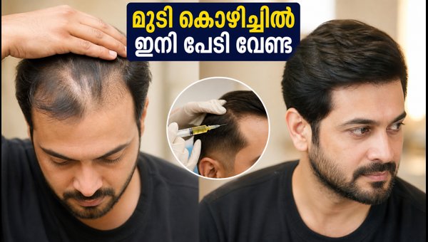 PRP Therapy for Hair Loss: Benefits, Costs, and Safety Guide 2026 PRP Therapy for Hair Loss: Benefits, Costs, and Safety Guide 2026