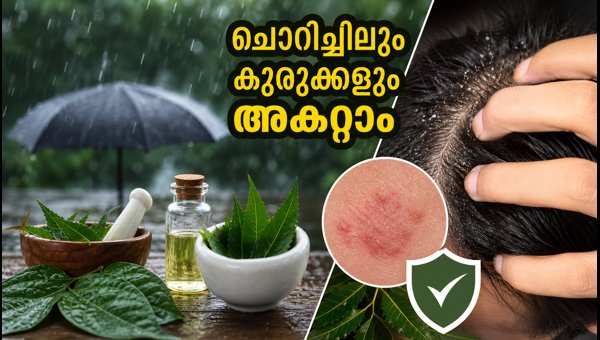 Kerala Rain Alert 2026: Essential Skin and Hair Care Tips for Humid Weather Kerala Rain Alert 2026: Essential Skin and Hair Care Tips for Humid Weather