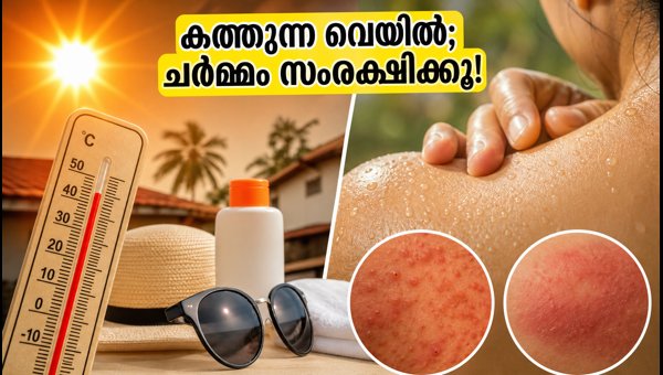 Skincare Tips for Kerala Heat and Humidity: Simple Ways to Protect Your Skin and Prevent Rashes in 2026