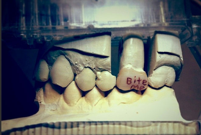 Cool Teeth Tattoo Images And Pictures!