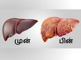 இந்த 12 பழக்கவழக்கங்கள் உங்கள் கல்லீரலை சேதப்படுத்துகின்றன என தெரியுமா?