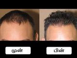 பலவீனமான முடியை வலிமையாக்க உதவும் சில அட்டகாசமான எளிய வழிகள்!