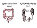 கழிவுகளை நீக்கி குடலை சுத்தமாக வைத்துக் கொள்ள, இத தினமும் 1 ஸ்பூன் சாப்பிடுங்க...