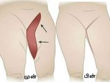 தொடையில் உள்ள கொழுப்புக்களை வேகமாக கரைக்க வேண்டுமா? அப்ப இத ஃபாலோ பண்ணுங்க...