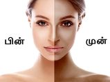 10 நிமிடத்தில் முகத்தில் இருக்கும் நீங்கா கருமையைப் போக்கும் அற்புத மாஸ்க்!