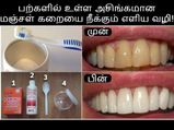 பற்களில் உள்ள அசிங்கமான மஞ்சள் கறையை எளிதில் நீக்க வேண்டுமா? அப்ப இத செய்யுங்க....