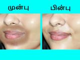 வாயைச் சுற்றி அசிங்கமாக இருக்கும் கருமையைப் போக்கும் வழிகள்!