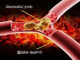 முக பகுதியில் உள்ள கொலஸ்ட்ராலை குறைக்க இதையெல்லாம் செய்தாலே போதும்..!  