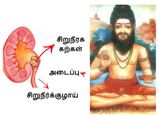 சிறுநீரக கற்களை எளிதில் கரைக்க, சித்தர்கள் கூறும் 8 மூலிகைகள் இதோ..!
