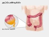 குடல்வால் பிரச்சினைக்கு இனி அறுவை சிகிச்சை வேண்டாம்... இந்த 10 பொருள்களை சாப்பிட்டாலே போதும்