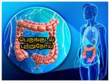 உங்களின் இந்த சாதாரண பழக்கங்கள் உங்களுக்கு பெருங்குடல் புற்றுநோய் வரமால் தடுக்குமாம் தெரியுமா?