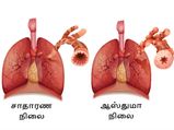 ஆஸ்துமா பிரச்சனை உள்ளவர்கள் சாப்பிடக்கூடாத உணவுகள்!