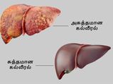 அசுத்தமான கல்லீரலை சுத்தம் செய்யணுமா? இத காலையில தினமும் ஒரு டம்ளர் குடிங்க...