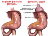 ஆண்களைத் தாக்கும் இரைப்பை ஏற்றம்.. இதை கண்டு கொள்ளாமல் விட்டால் சந்திக்கும் அபாயம் என்ன தெரியுமா?