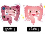 மாத்திரை எதுவும் போடாமல் குடலை ஈஸியா சுத்தம் செய்யணுமா? அப்ப இத படிங்க...